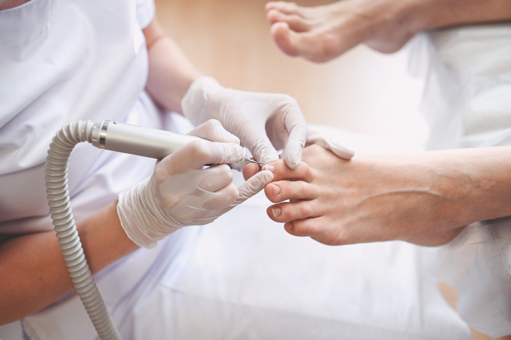 oncologische voetzorg
